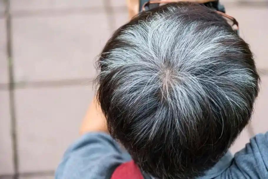 人一生得癌概率有多高?医生:头发早白的人，癌症风险或更低? 你是不是也有过这