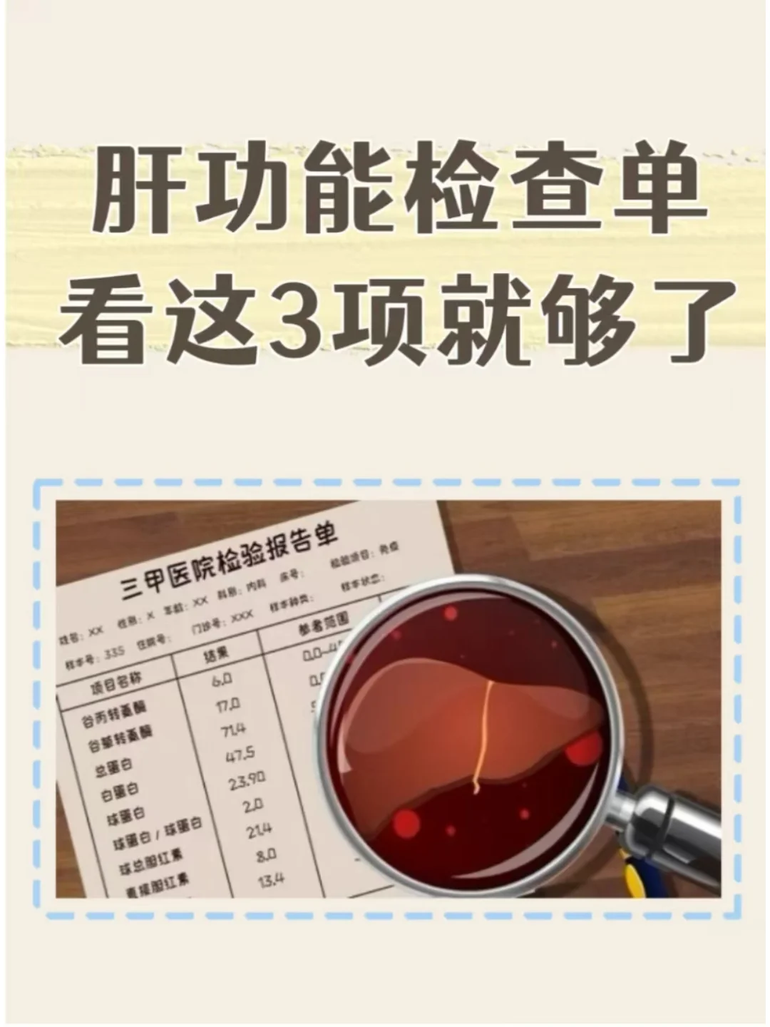 肝功能检查单，看这3项就够了！