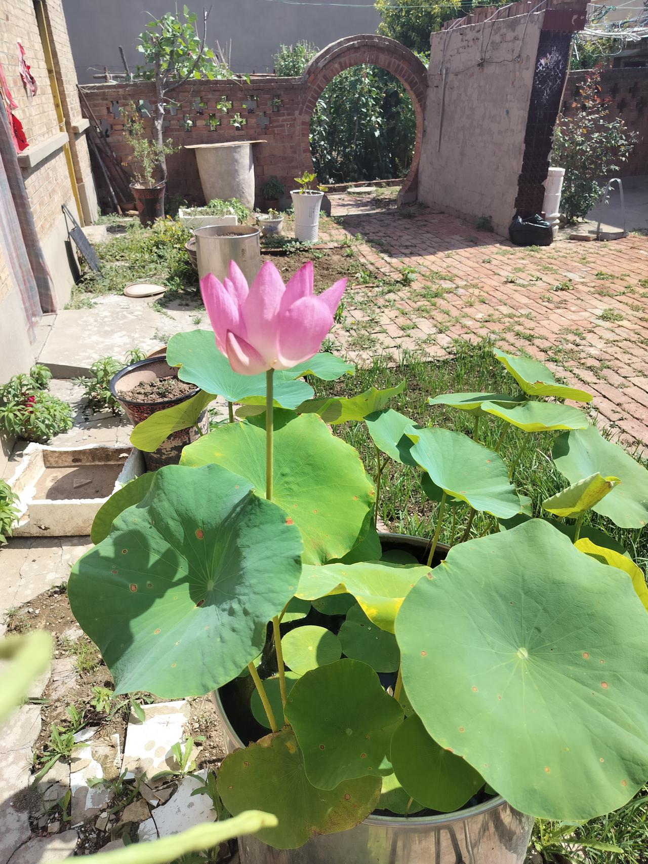 今天上午去医院了，我老公的堂嫂在重症已经住了20天，她是糖尿病并发症，心衰肾衰，