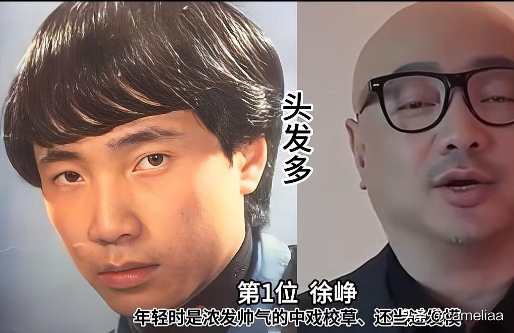 从发量王者到光头模样一晃半生模样大变谁懂啊！以前的这些男神，发量浓密到
