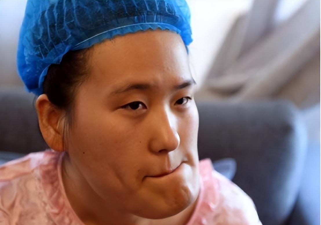 辽宁“歪脸女孩”赵宏秋，父母早逝，因面部畸形求职屡屡碰壁。后来在好心人帮助下成功
