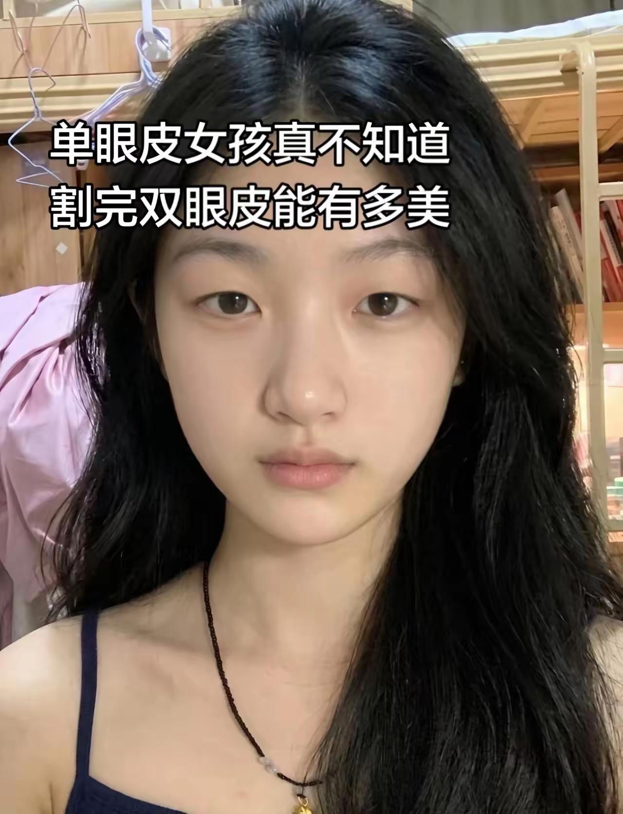 单眼皮的女生，一旦做了双眼皮，感觉换了一张脸似的。难怪有人说，单眼皮的女生，个