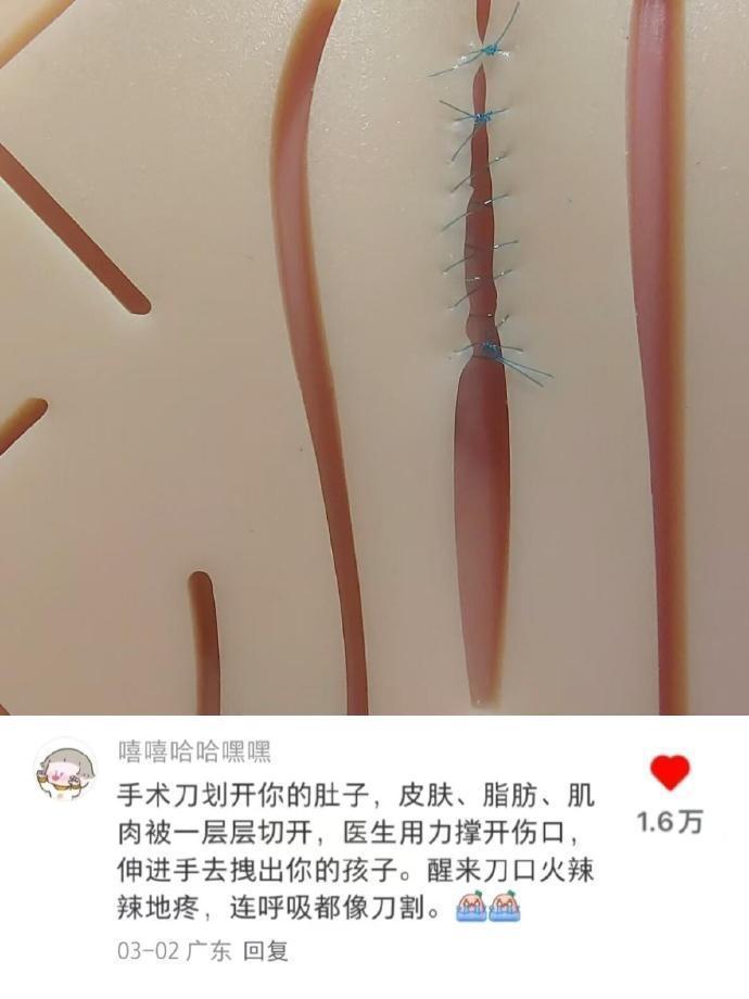 生育损伤的冷知识我什么时候才能学完？