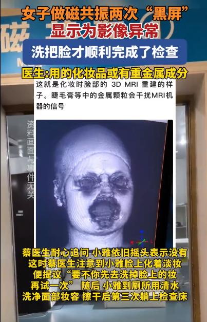 解释不清了！福建一29岁女生头晕，去医院做头颅磁共振。不料，连续2次扫描，都因面