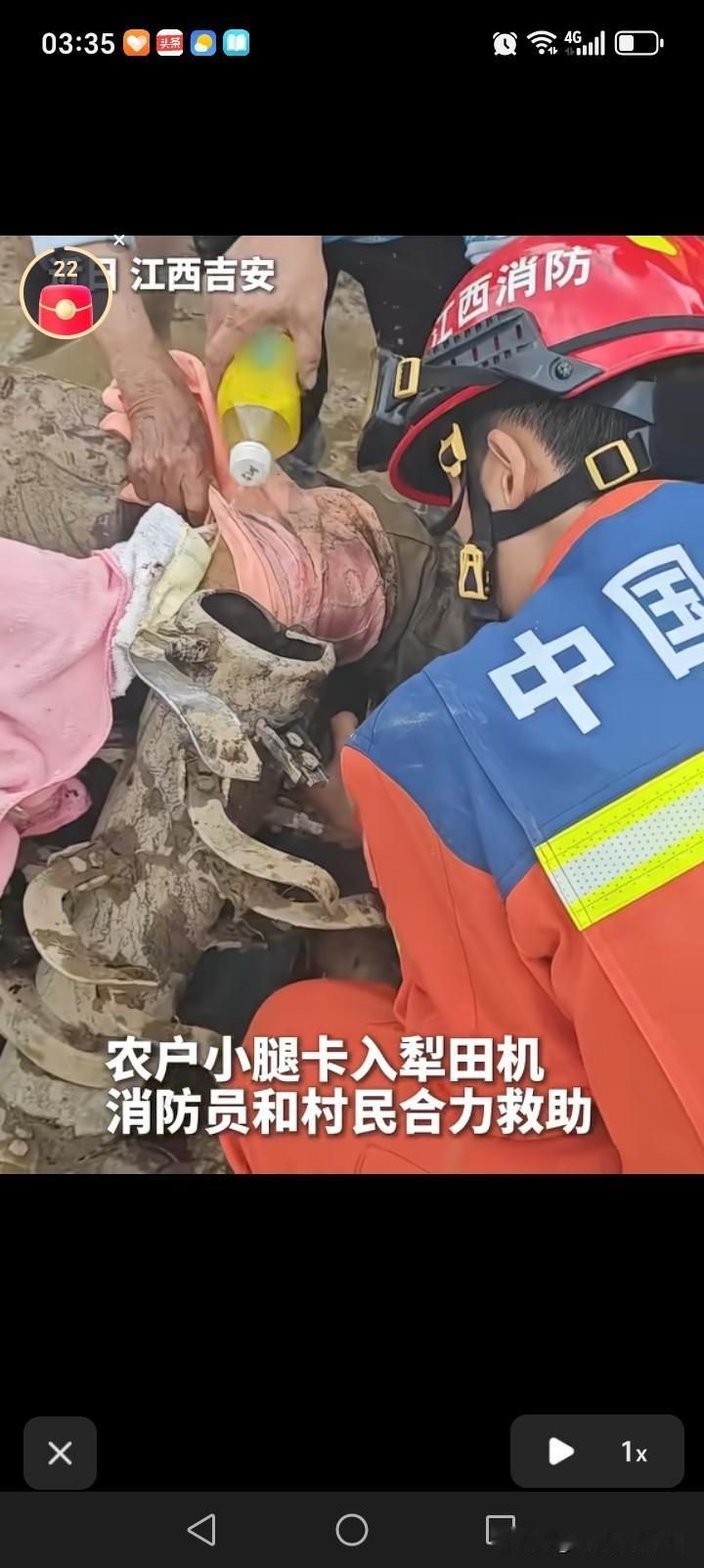 近日，江西吉安一农户犁田时，小腿被犁刀贯穿，倒在田里，生命垂危。事故发生后，同村