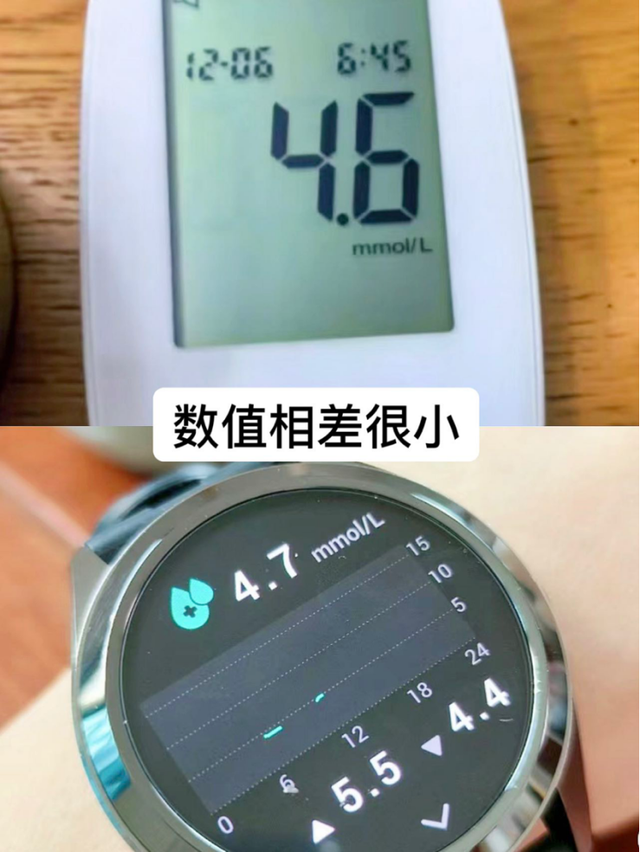 医学界如何评价血糖手表的可靠性? 专家们的看法一探究竟!