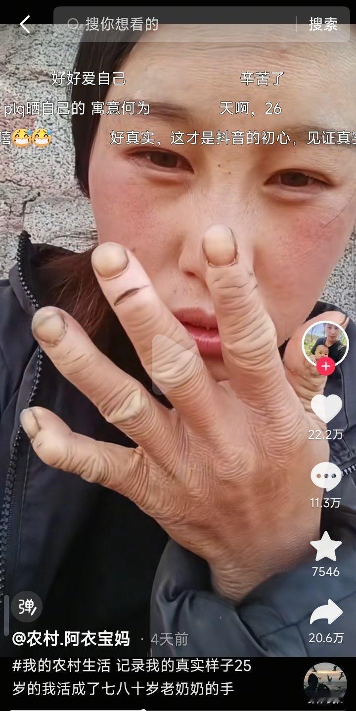 太扎心了！抖音上一位宝妈发视频展示自己因为平时劳作和天气寒冷而粗糙变形的手，但媎