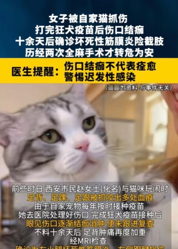 西安赵女士被自家猫抓伤，本以为打了疫苗、伤口结痂就万事大吉，结果十几天后脚背肿痛