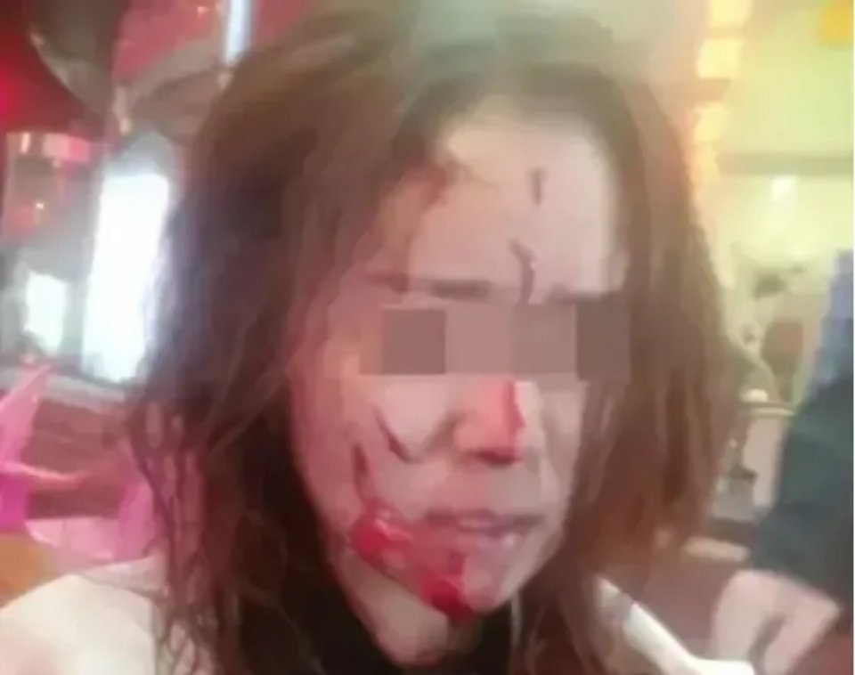 河南郑州，一名女子租房房东提前收房引冲突，遭房东暴力殴打，3个月孩子也未能幸免，