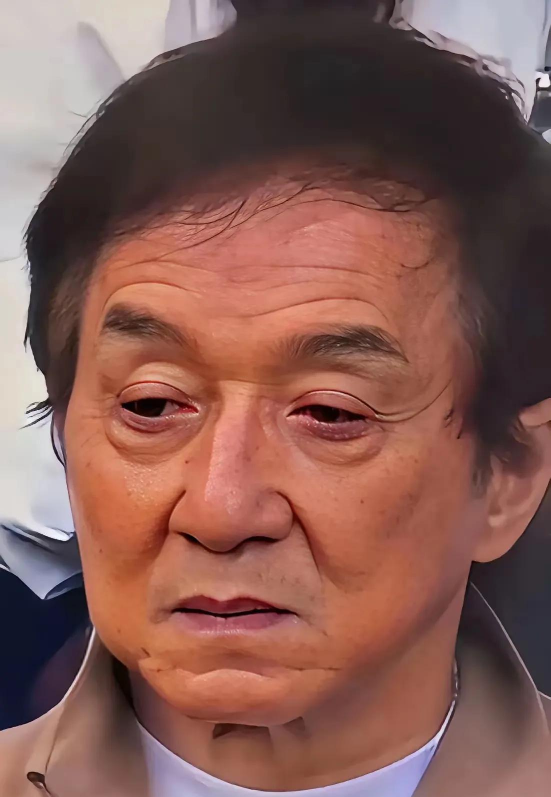 明星那么有钱还是逃不脱自然规律的生老病死！就说生病这事，按理说像李咏这样