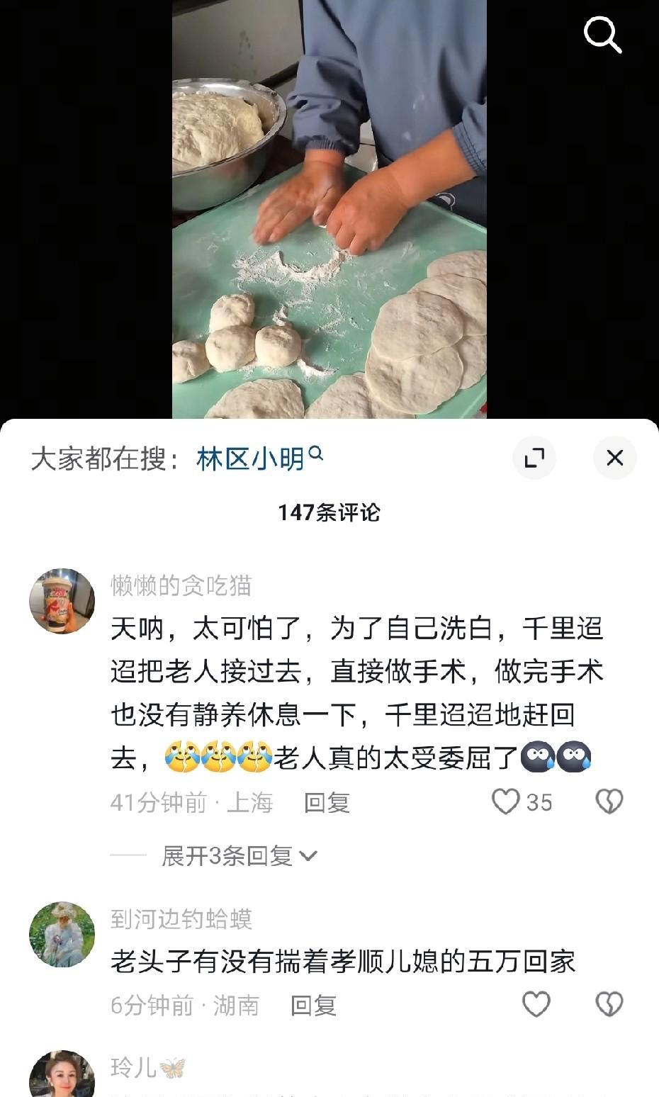 看看粉丝怎么评价林区小明的，要不有些人总说我黑他。今天林区小明妹妹发了条视频说他
