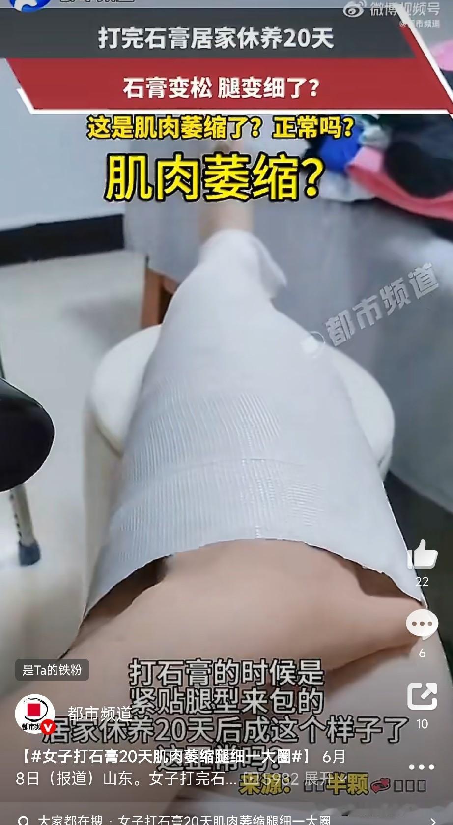 女子打石膏20天肌肉萎缩腿细一大圈原本打得严丝合缝、紧紧贴着腿的石膏，只过