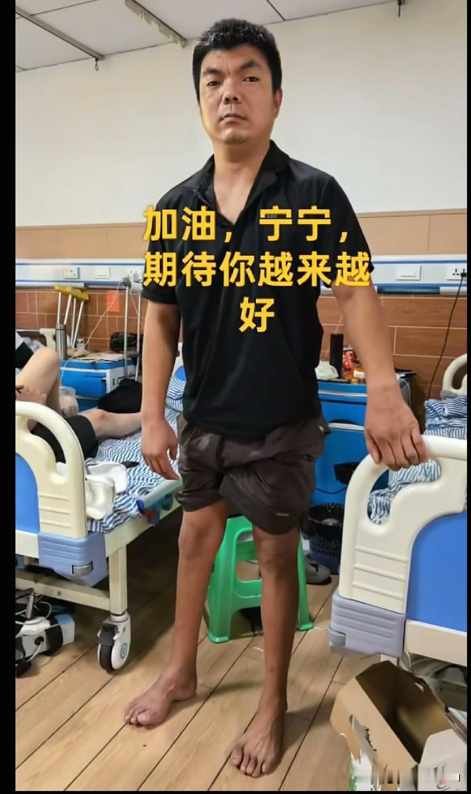 宁宁的脚手术后确实平坦了，但由于长年累月踮脚，两只脚骨头高低都不一样了，不知道以