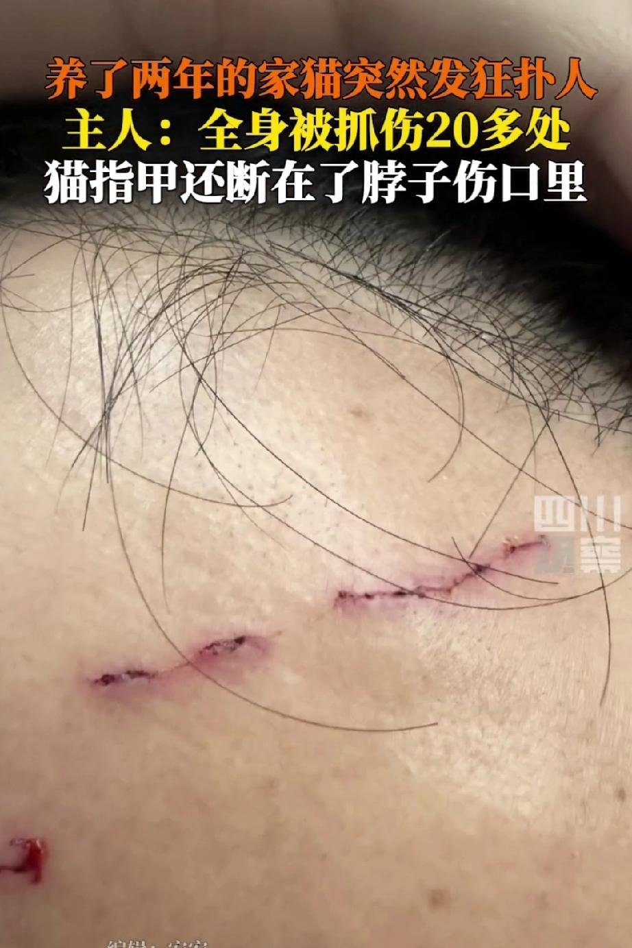 养了两年的猫突然发狂扑人，男主人被抓20多处伤口，连睡裤都被抓了一个大窟窿猫指甲