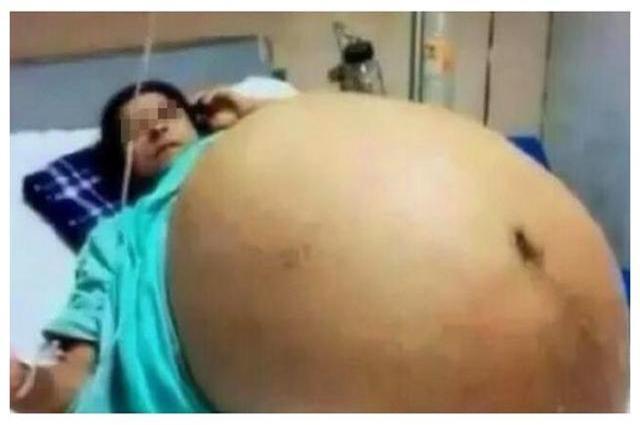 陕西27岁孕妈剖腹产三胞胎, 结果护士抱出四个! 宝爸取的名字亮了