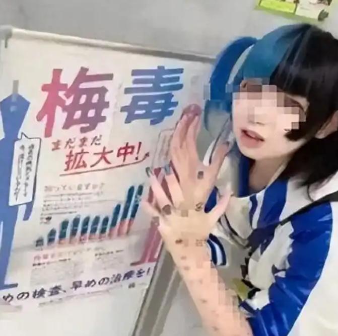 日本梅毒大爆发，确诊病例高达13000例。更要命的是，这些感染者，不以为耻，