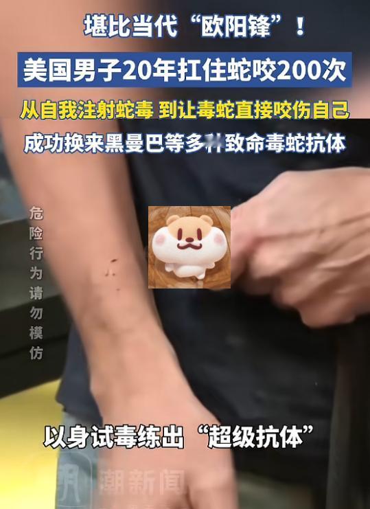 “活久见！”美国，一男子出于对毒蛇的好奇，开始少量注射蛇毒，并且慢慢加大剂量，最