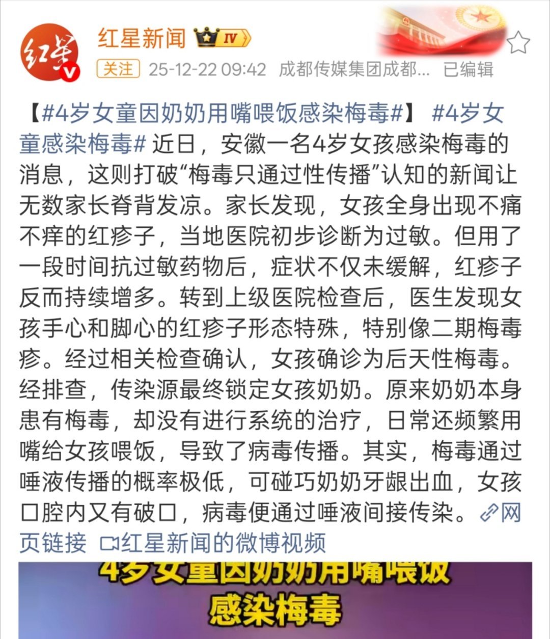 2个月宝宝被奶奶碘伏擦进ICU上次还有嘴对嘴喂出梅毒来的，还是那句话科学喂养，有