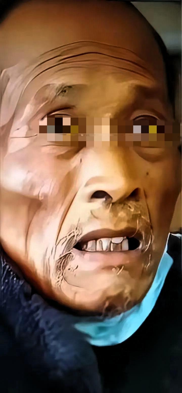 遗憾一生！父亲在医院被检查出肝癌中期，儿子因手里没钱，只能骗他说暂无有效治疗方案