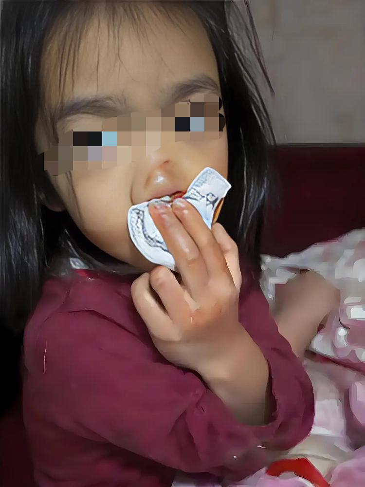 一巴掌把5岁娃扇得鼻血直流，就因为擦碗没擦干净？这亲奶奶的手，也太狠了点吧！换