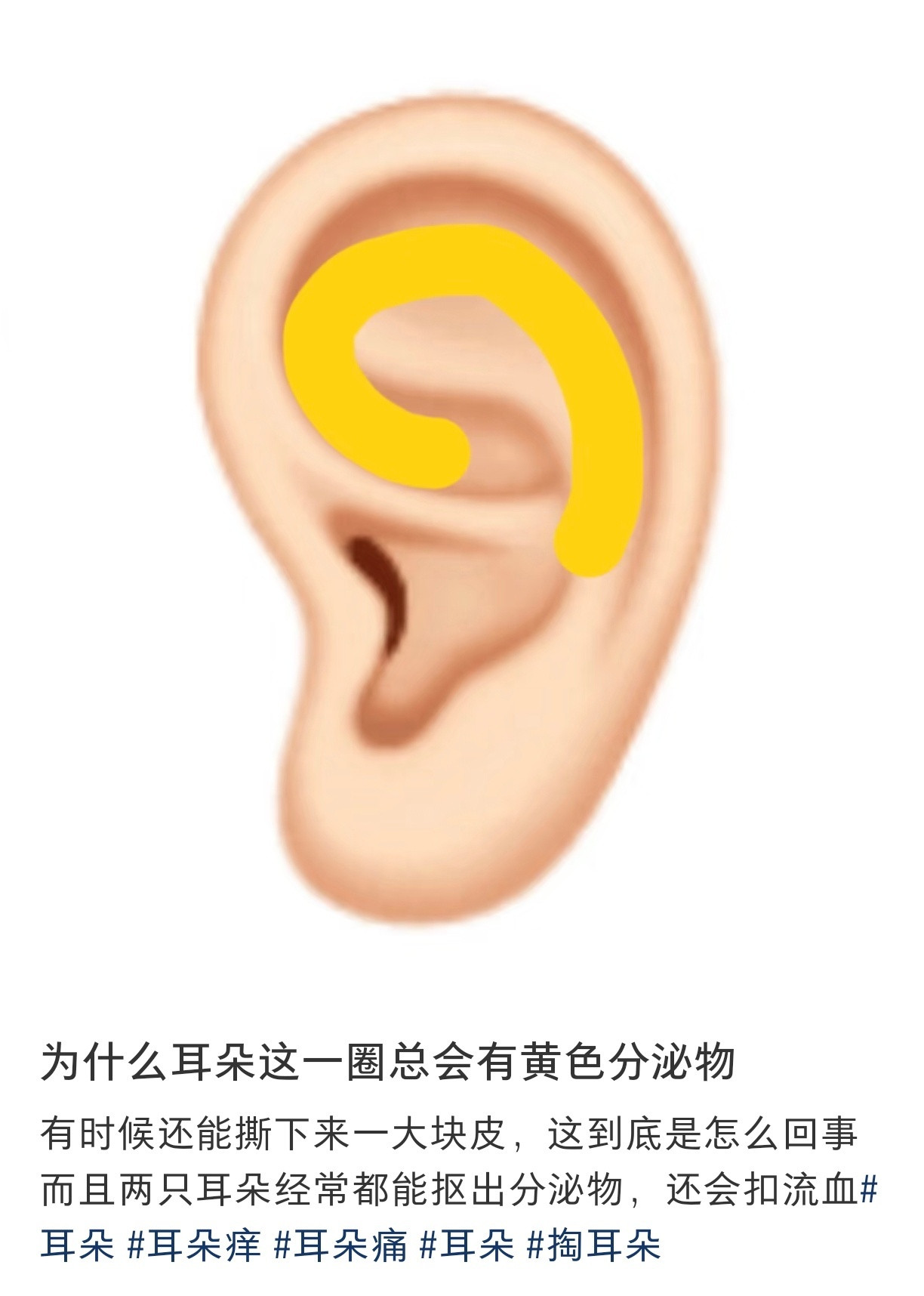 终于有人科普了耳朵这一圈的黄色分泌物​​​