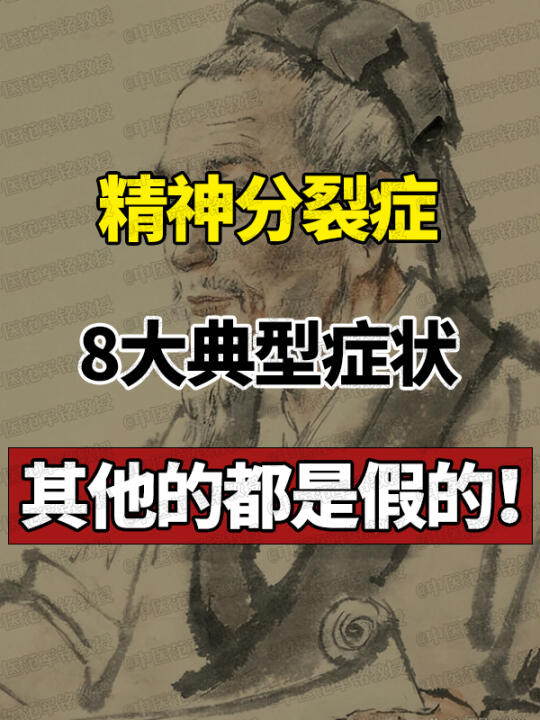 精神fen裂症，8大典型症状，其他的都是假的！ ﻿精神分裂﻿ ﻿抑郁焦...