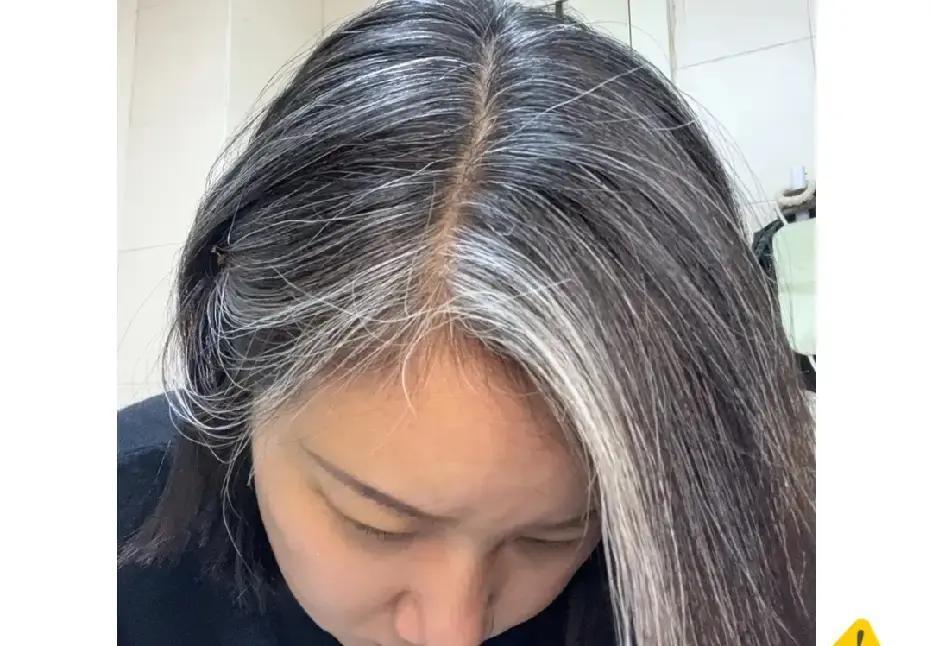 粗硬发30岁集体白头？真相扎心哈佛刚发论文：头发越粗，毛囊里那口“墨缸”烧