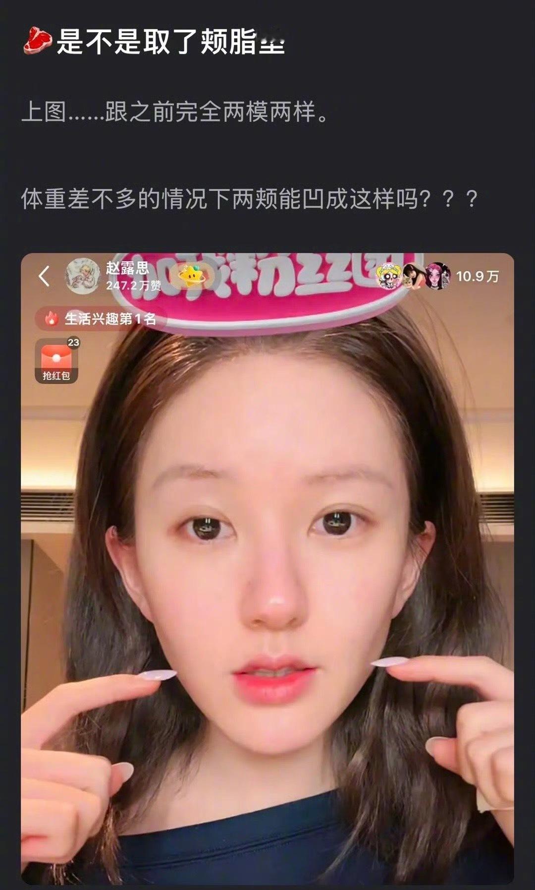 赵露思的脸被指跟之前完全两模两样，怎么看？