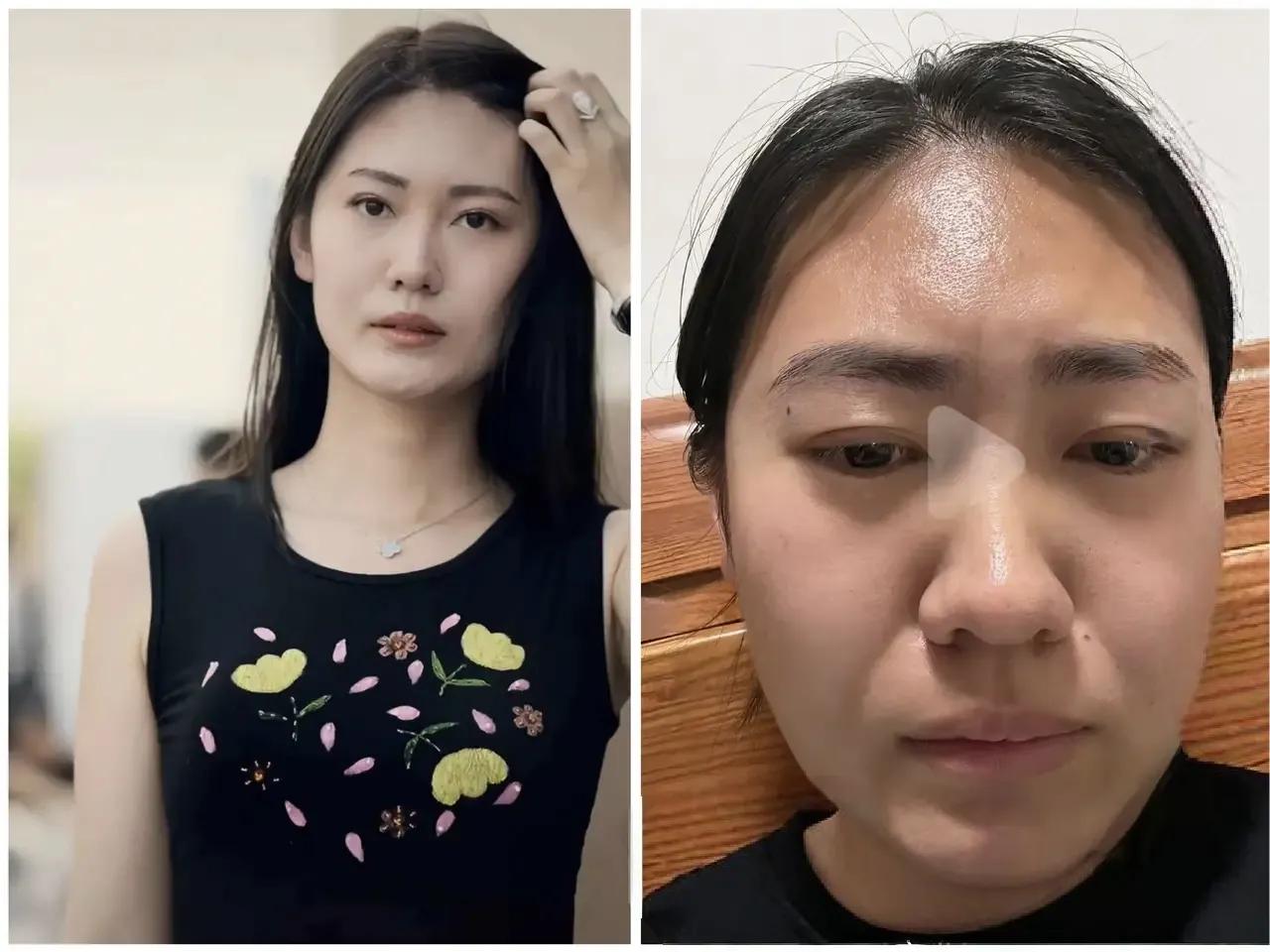 才29岁宋珍珍，长相气质都不差，往后想要结婚基本没戏了。最近看到宋珍珍的事，心里
