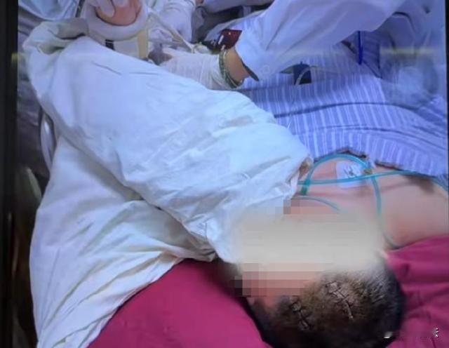 上海，46岁的蒋女士在家突然头疼，同事来家发现她昏迷不醒立刻送去医院。蒋女士单身