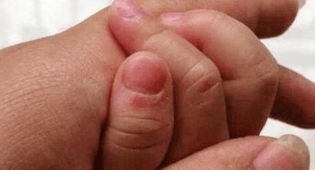 如果你的孩子手上有这个, 宝妈要注意了