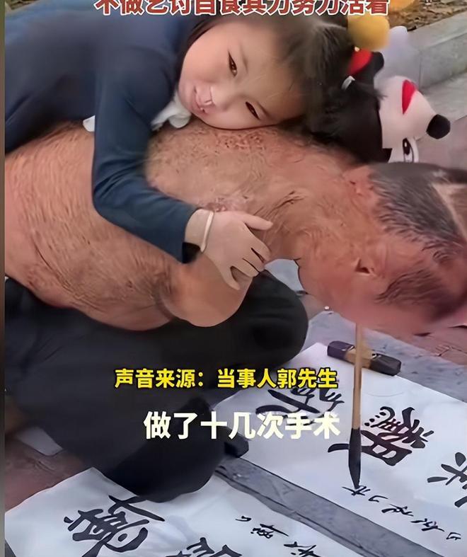 看哭了！山东聊城，丈夫意外失去双臂，妻子无情离婚，抛弃丈夫和女儿，丈夫天天拼命用