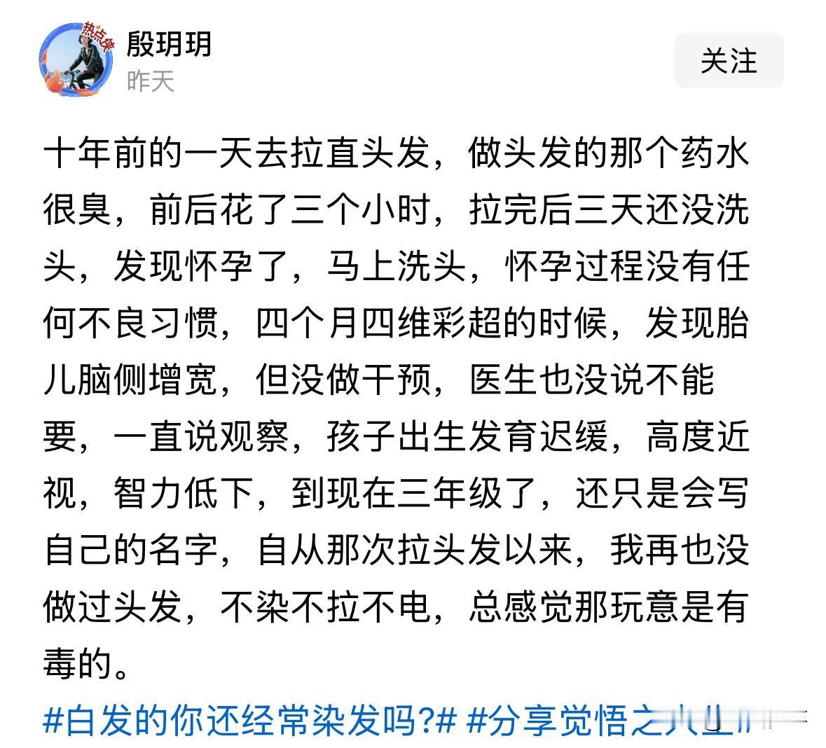 你染发吗？1、朋友以前年轻那会在理发店给人洗头，干了三年吧，然后学会理发自己给