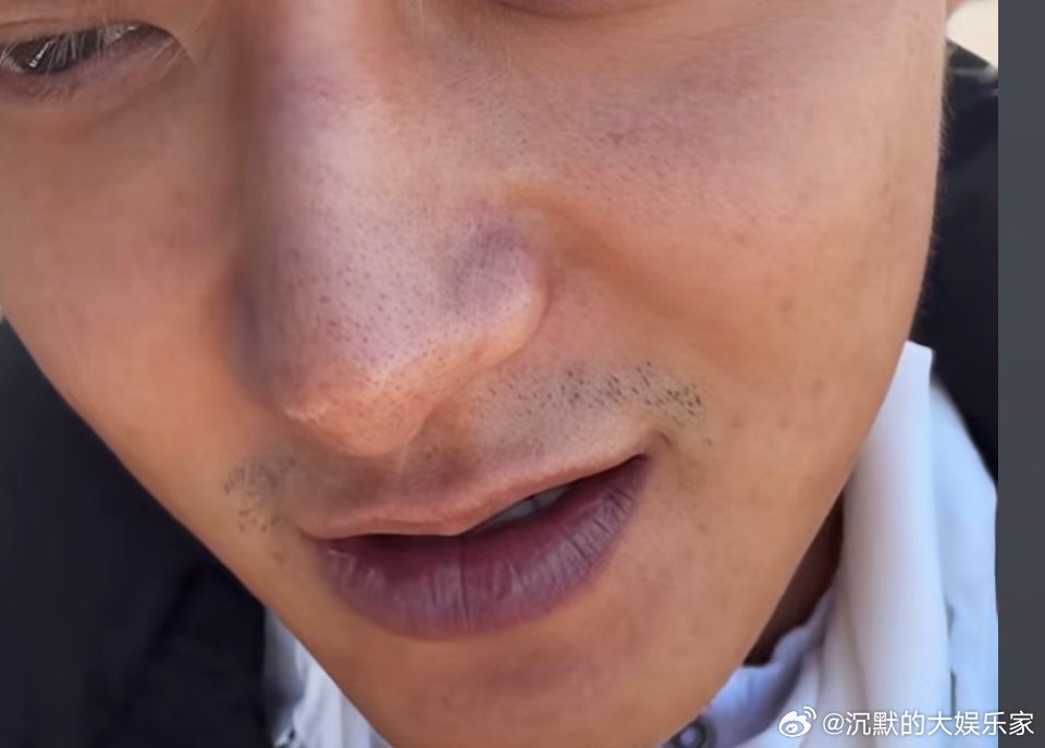 起因是有网友发现黄子韬嘴唇发紫，担心他心脏有问题。结果黄子韬还是那副大大咧咧的样