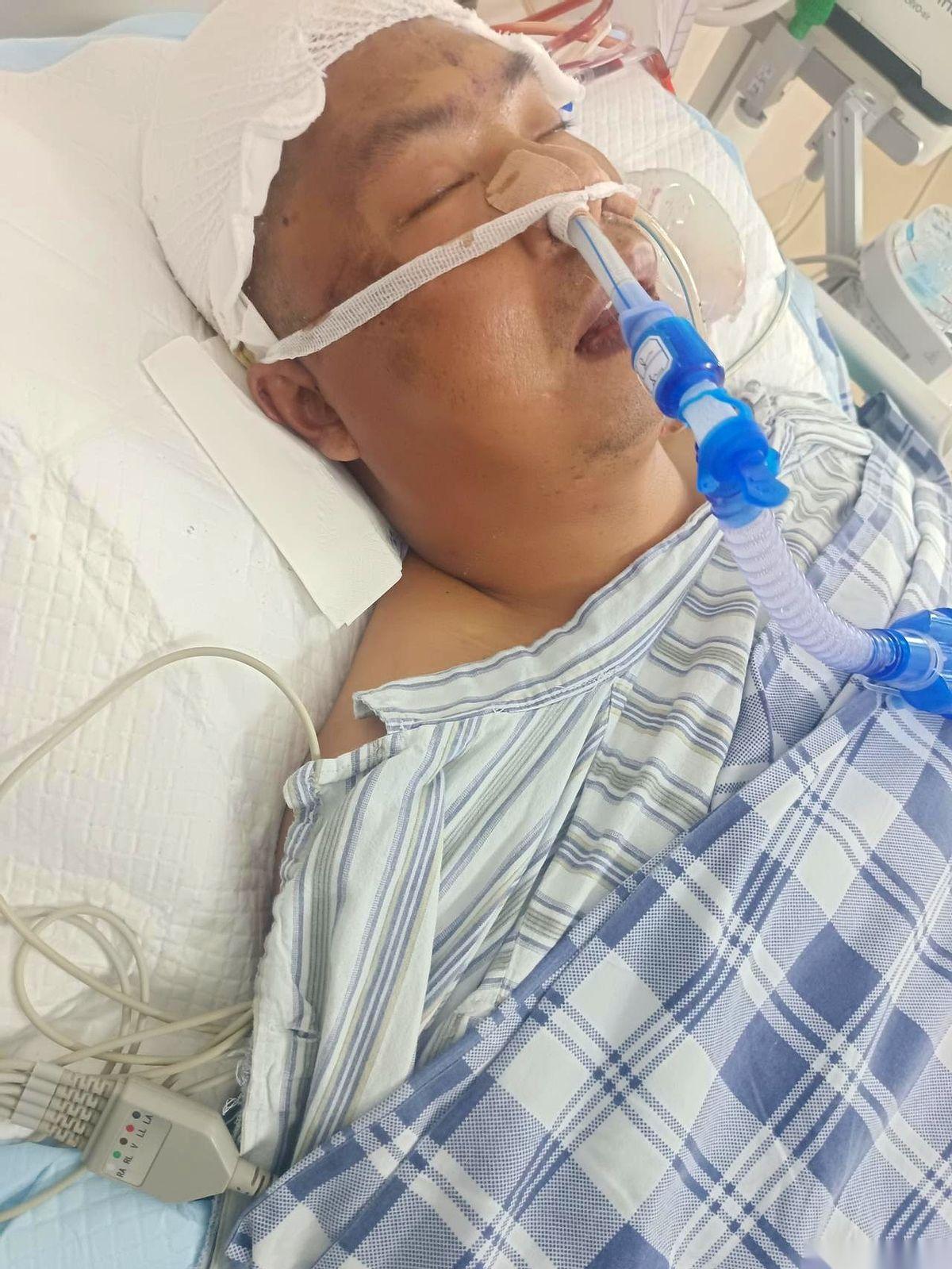 他嘴里吐出一大口黑血，眼睛都翻白了，我疯了一样喊医生。谁能想到呢？中午他明明