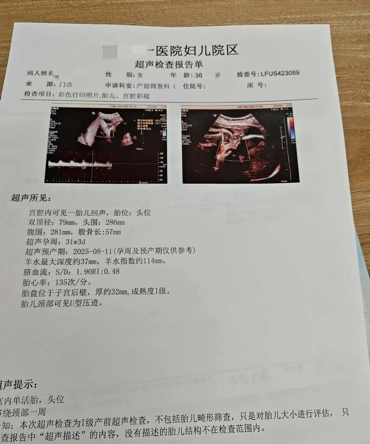 有孕妈妈孕期胎儿总是偏大的吗？昨天去产检了，彩超单子上依然显示胎儿偏大，本来按
