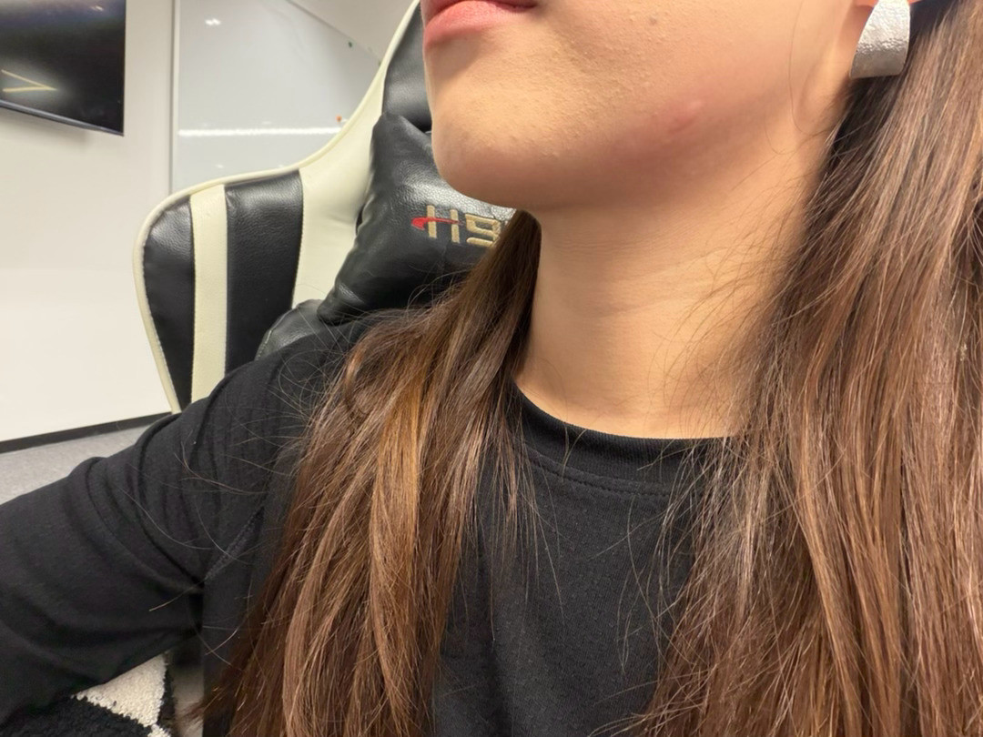 这蚊子可真烦人阿🤬​​​