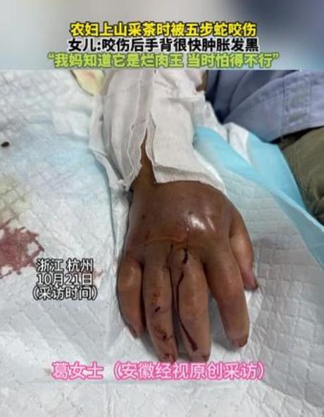 “悲剧还是发生了！”近日，浙江杭州，一女子上山采茶叶时，忽然感觉手被扎了一下，低