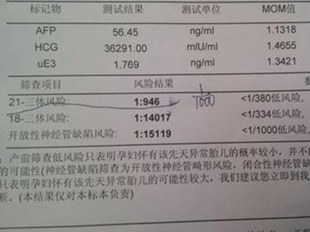 羊水穿刺可以看出男女吗 可以看胎儿性别2-3周出结果