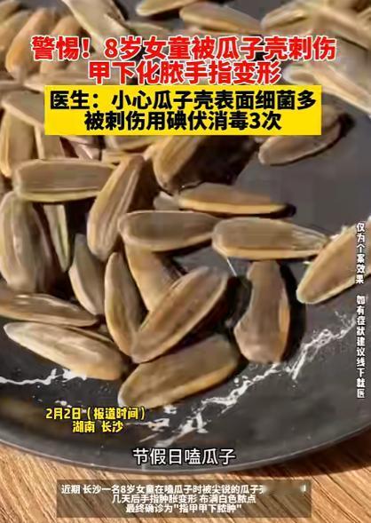 湖南，一女孩在家嗑瓜子时，不小心让一枚尖锐的瓜子壳戳进了指甲，家人以为只是小问题