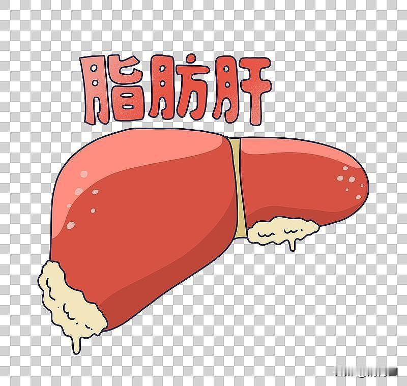 全国每3人中就有1人有脂肪肝肝脏不会喊疼，但数据已经敲响了警钟——每三个人里就有