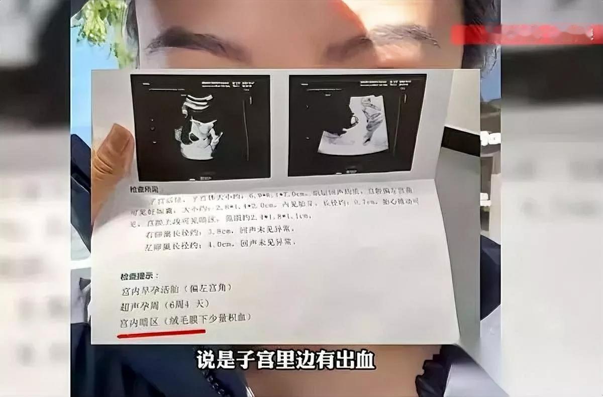 吓人！孕妈暖脚竟险失宝宝北京一孕妇用暖水袋捂肚子，没几天突然腹痛。医生检查后