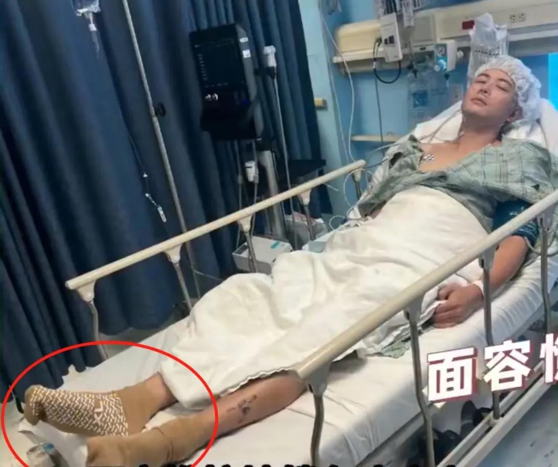 陈学冬因为车祸，做了四次手术，目前还不能自理！这么惨啊，难怪已经好久没有看他