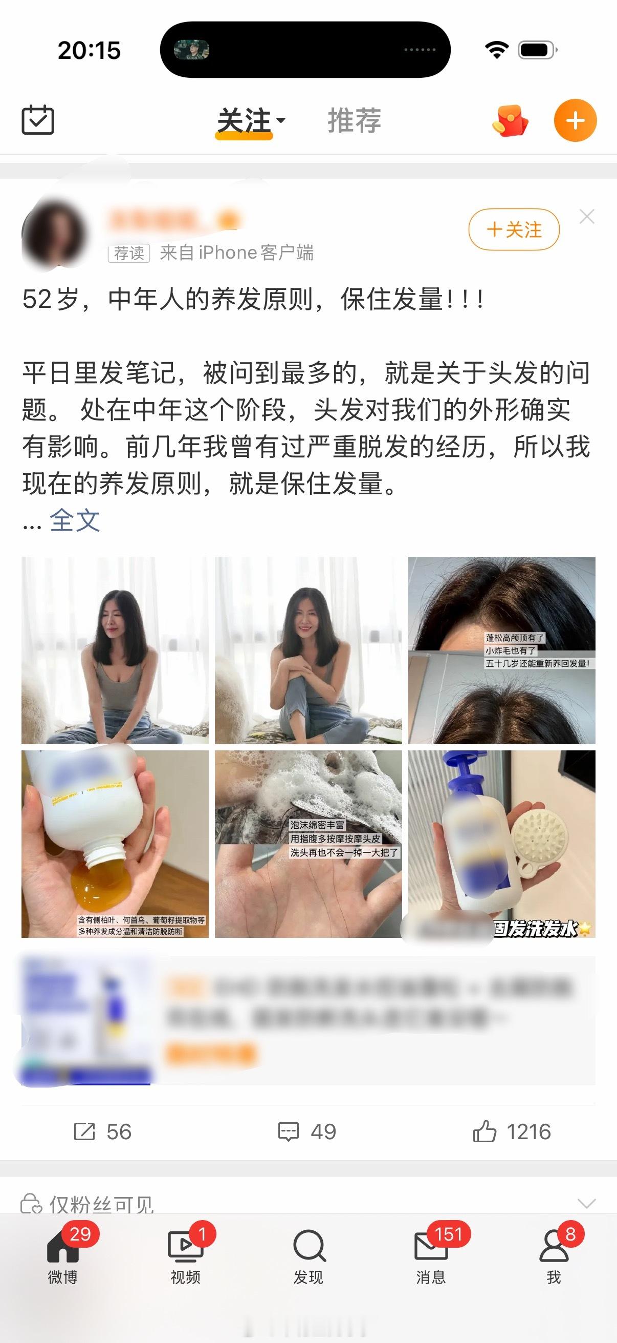 不是，我这二十来岁的小伙子，干嘛老给我推脱发的广子[？？？][？？？][？？？][费解