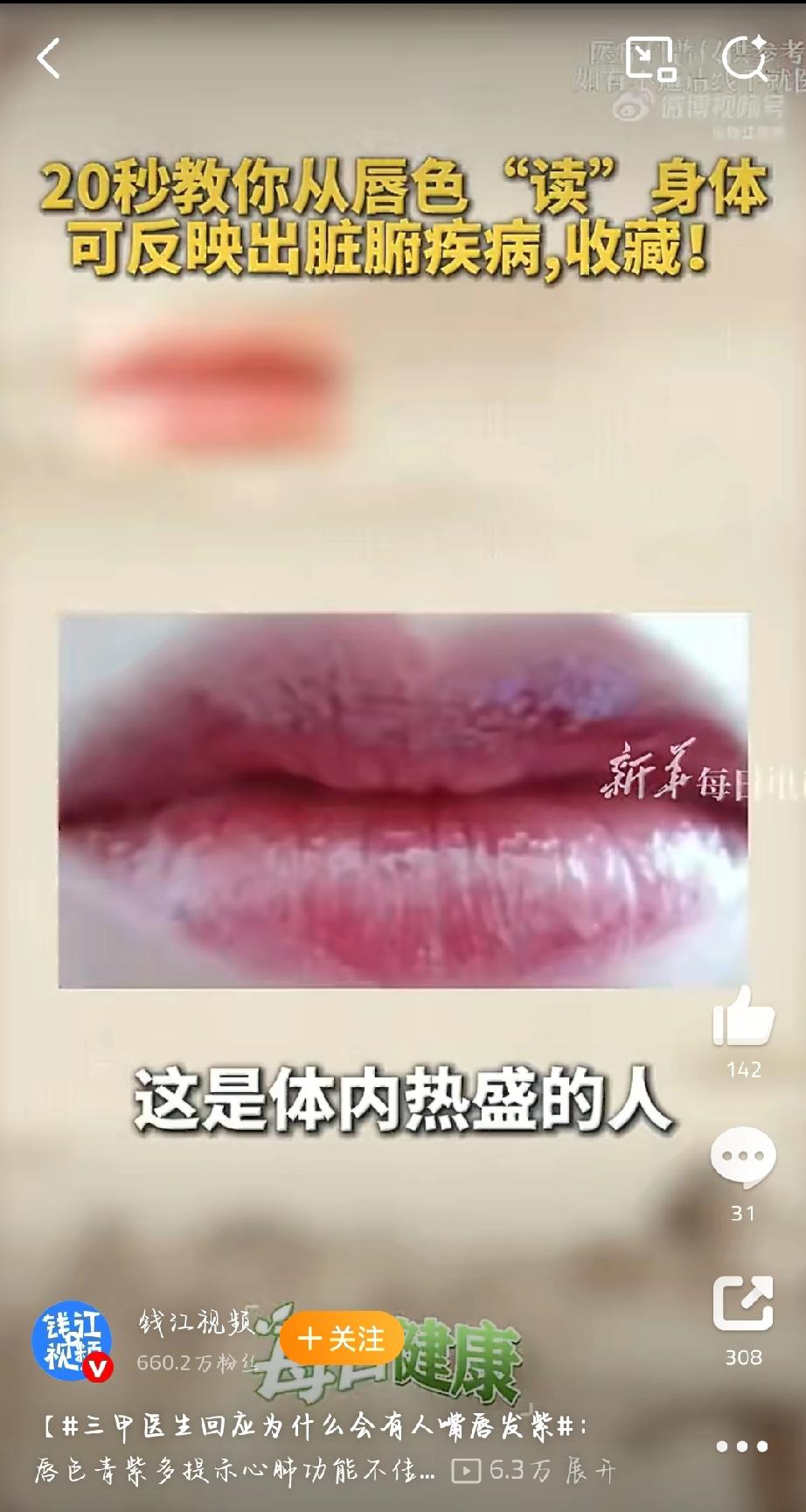 三甲医生回应为啥有人嘴唇发紫，这里面门道可不少。嘴唇发紫，医学上叫紫绀，多和血液