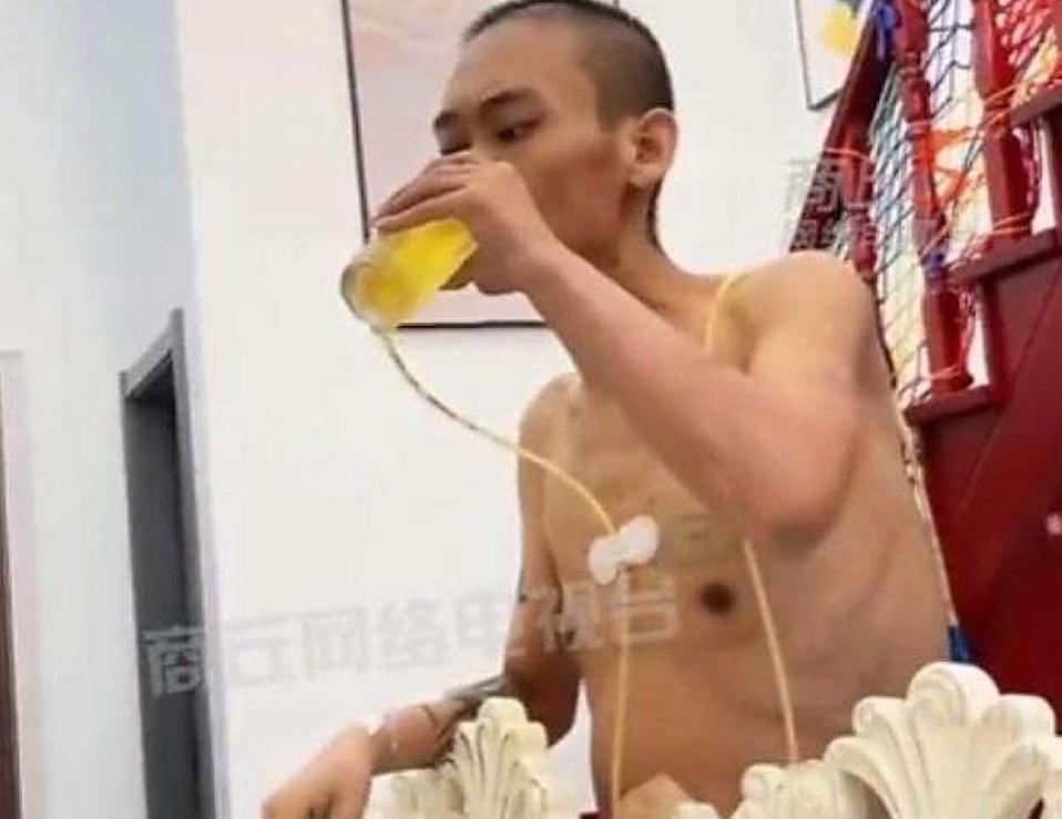 人都瘦脱相了，肚皮上还贴着引流管，你猜这大哥手里死死攥着啥？不是救命药，而是一罐