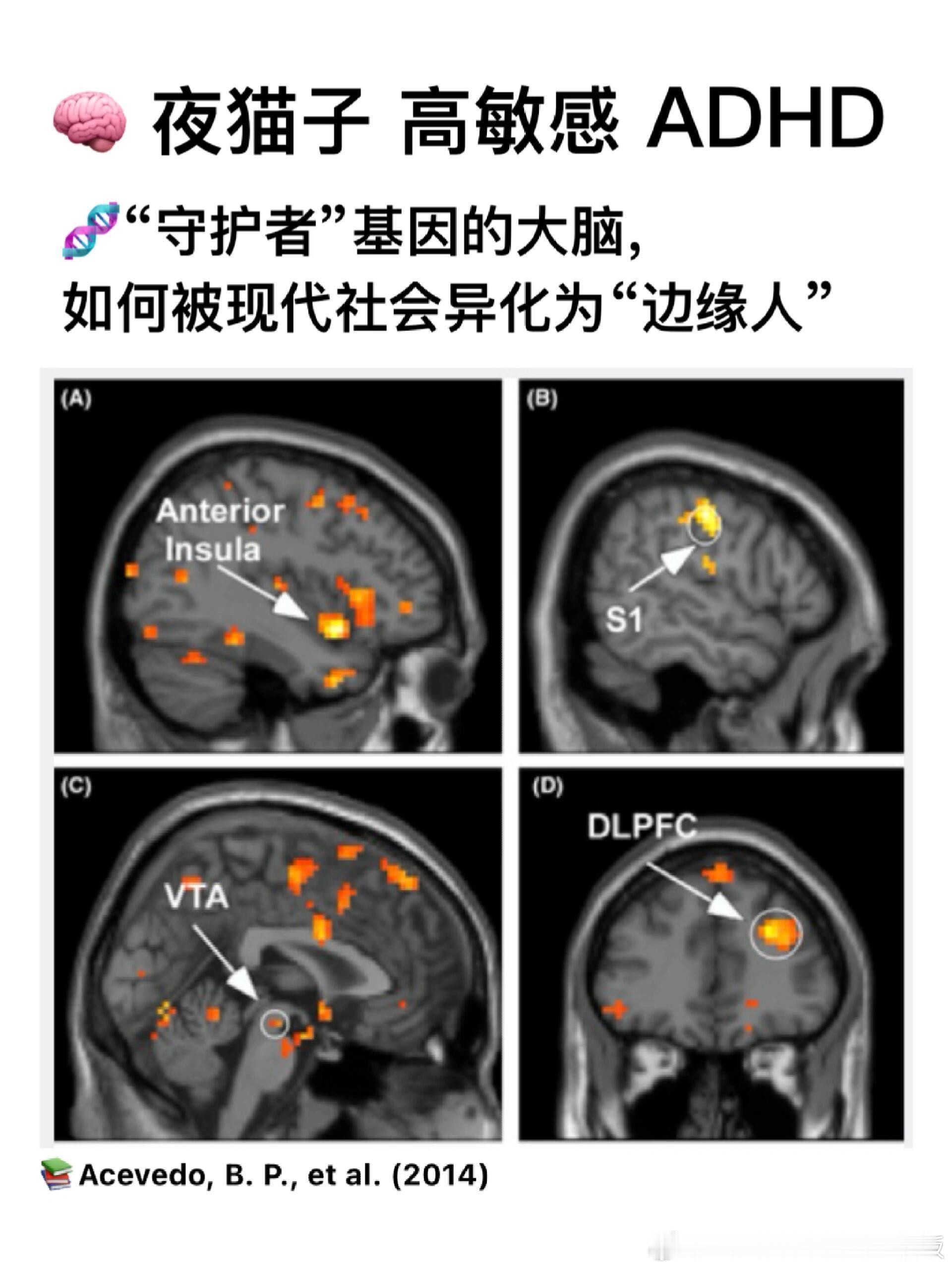 有些大脑不是为“朝九晚五”而生​​​