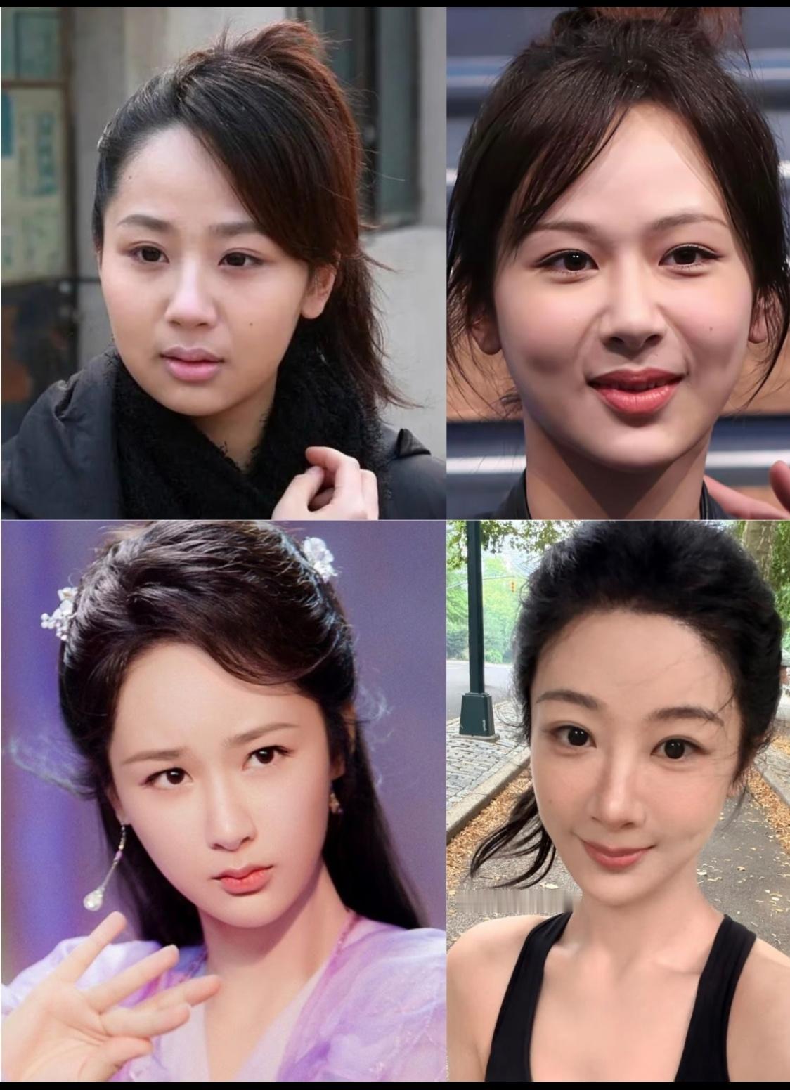 杨紫这是长大了还是医美了？？？