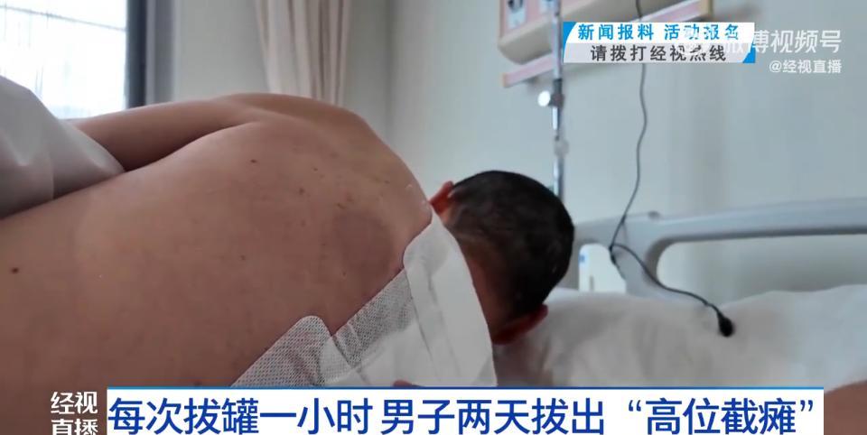 “悲剧还是发生了！”湖北武汉，一男子长期感觉腰背疼痛，他认为是体内湿气过重，就买