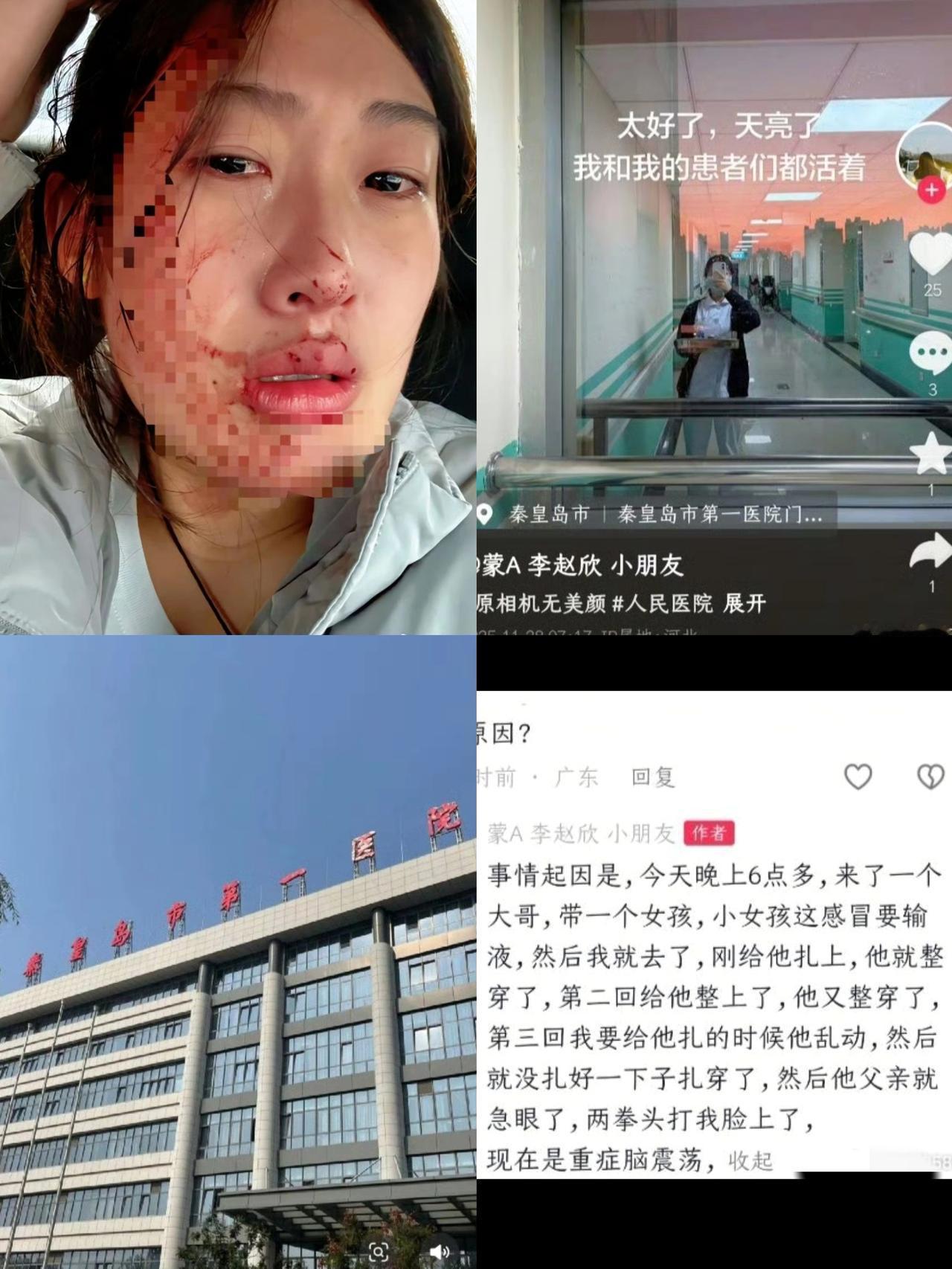 暴力人格果然要不得23岁女护士被打不是因为她技术不过硬，也不是因为她态度